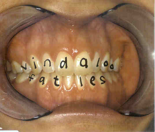 Fat Les - Vindaloo (CD, Single, Nim)